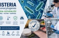 Listeria monocytogenes ve Gıda Güvenliği: Bilmeniz Gerekenler